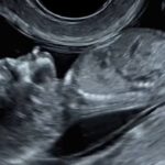 Lord, morning sickness sucks & I’m over it!