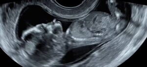 Read more about the article Lord, morning sickness sucks & I’m over it!
